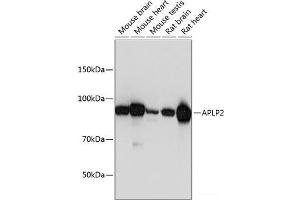 Western blot analysis of extracts of various cell lines using APLP2 Polyclonal Antibody at dilution of 1:1000. (APLP2 anticorps)
