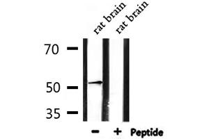 Western blot analysis of extracts from rat brain , using ADRA1A Antibody. (alpha 1 Adrenergic Receptor anticorps  (Internal Region))