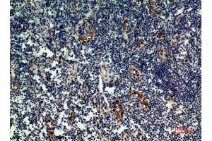 Immunohistochemistry (IHC) analysis of paraffin-embedded Human Tonsilla, antibody was diluted at 1:100. (IL-33 anticorps  (Internal Region))