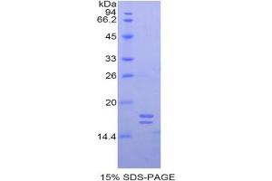 SDS-PAGE analysis of Human Glycocalicin Protein. (Glycocalicin Protéine)