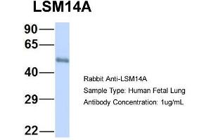 Host: Rabbit  Target Name: LSM14A  Sample Tissue: Human Fetal Lung  Antibody Dilution: 1. (LSM14A anticorps  (C-Term))