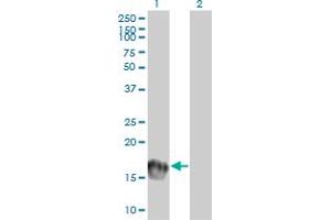 Western Blot analysis of UBE2C expression in transfected 293T cell line by UBE2C monoclonal antibody (M01), clone 9D3. (UBE2C anticorps  (AA 70-179))