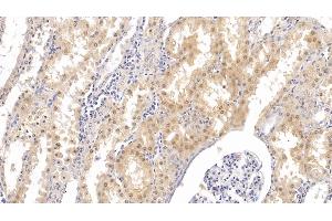 Detection of PTHR2 in Human Kidney Tissue using Monoclonal Antibody to Parathyroid Hormone Receptor 2 (PTHR2) (PTH2R anticorps  (AA 27-145))