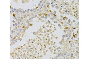 Immunohistochemistry of paraffin-embedded Mouse testis using PFKFB3 Polyclonal Antibody at dilution of 1:100 (40x lens). (PFKFB3 anticorps)
