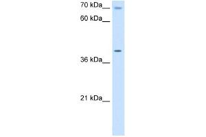WB Suggested Anti-COX15 Antibody Titration:  5. (COX15 anticorps  (N-Term))