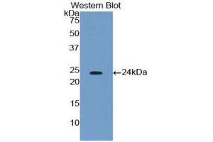 Western Blotting (WB) image for anti-Phospholipase A2, Group IVA (Cytosolic, Calcium-Dependent) (PLA2G4A) (AA 563-749) antibody (ABIN1174847) (PLA2G4A anticorps  (AA 563-749))