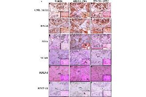 Effect of ADSC administration on expression of AGE-RAGE axis mediated activation of catabolic signalling pathways.