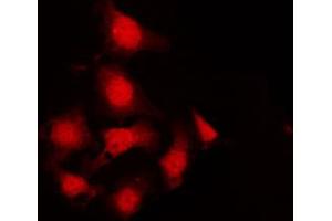 ABIN6267242 staining K562 by IF/ICC.