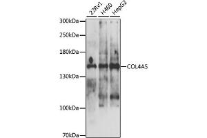 Western blot analysis of extracts of various cell lines, using COL4 antibody (ABIN6130196, ABIN6138845, ABIN6138846 and ABIN6225111) at 1:1000 dilution. (COL4a5 anticorps  (AA 1462-1691))