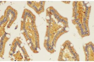 Immunohistochemistry of paraffin-embedded Human duodenum using ST14 Ployclonal Antibody at dilution of 1:200. (ST14 anticorps)