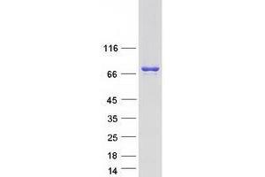 Validation with Western Blot