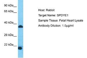 Host: Rabbit Target Name: SPDYE1 Sample Type: Fetal Heart lysates Antibody Dilution: 1. (SPDYE1 anticorps  (N-Term))