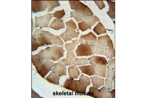CFB Antibody immunohistochemistry analysis in formalin fixed and paraffin embedded human skeletal muscle followed by peroxidase conjugation of the secondary antibody and DAB staining. (Complement Factor B anticorps  (AA 469-494))