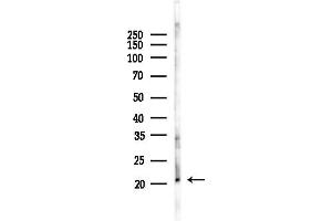 anti-Regulator of G-Protein Signaling 5 (RGS5) (Internal Region) antibody