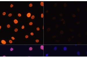 Immunofluorescence analysis of C6 cells using Acetyl-Histone H3-K4 Polyclonal Antibody at dilution of 1:100. (Histone 3 anticorps  (acLys4))