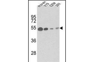 Western blot analysis of anti-TBB1 Antibody (ABIN658975 and ABIN2838004) in mouse brain tissue, Y79, CEM and 293 lysates (35 μg/lane).