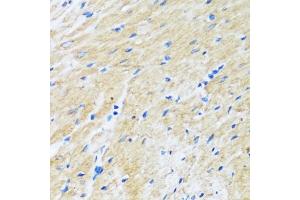 Immunohistochemistry of paraffin-embedded rat heart using B antibody (ABIN7265851) at dilution of 1:100 (40x lens).