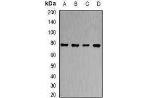 Western blot analysis of RBAT expression in HT29 (A), HepG2 (B), PC12 (C), mouse liver (D) whole cell lysates. (SLC3A1 anticorps)