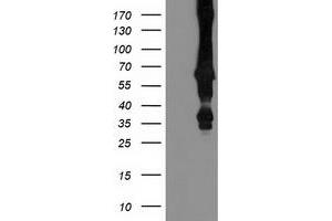 Western Blotting (WB) image for anti-Mahogunin, Ring Finger 1 (MGRN1) antibody (ABIN1499460) (Mahogunin RING Finger Protein 1 anticorps)