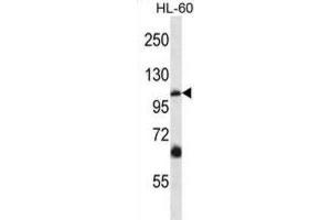 Western Blotting (WB) image for anti-Transient Receptor Potential Cation Channel, Subfamily C, Member 5 (TRPC5) antibody (ABIN2997528)