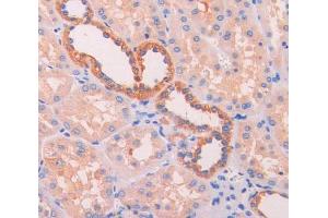 IHC-P analysis of kidney tissue, with DAB staining. (UCP2 anticorps  (AA 154-289))
