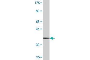 Western Blot detection against Immunogen (38. (S100A9 anticorps  (AA 1-114))