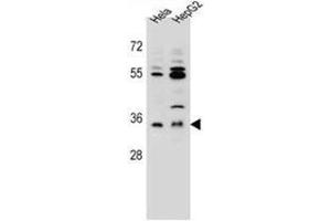 AKR1C3 Antibody (Center) western blot analysis in Hela,HepG2 cell line lysates (35ug/lane). (AKR1C3 anticorps  (Middle Region))