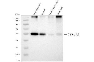 Western blot analysis of MG53/TRIM72 using anti-MG53/TRIM72 antibody (ABIN7601079).