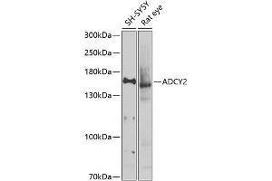 Western blot analysis of extracts of various cell lines, using  antibody (ABIN6129185, ABIN6136559, ABIN6136560 and ABIN6225105) at 1:1000 dilution. (ADCY2 anticorps  (AA 430-600))