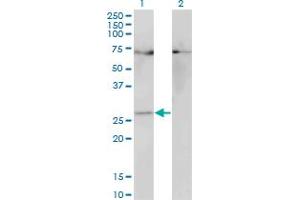 Western Blot analysis of HOXB7 expression in transfected 293T cell line by HOXB7 monoclonal antibody (M05), clone 3F3.