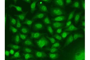 Immunofluorescence analysis of A549 cells using RAD17 antibody.