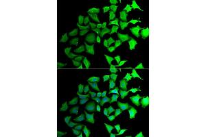 Immunofluorescence analysis of HeLa cells using TALDO1 antibody (ABIN5974092). (TALDO1 anticorps)