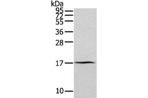 Gel: 12 % SDS-PAGE, Lysate: 40 μg, Lane: Human normal kidney tissue, Primary antibody: ABIN7193094(ZFAND2A Antibody) at dilution 1/300 dilution, Secondary antibody: Goat anti rabbit IgG at 1/8000 dilution, Exposure time: 2 minutes (ZFAND2A anticorps)