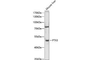 Western blot analysis of extracts of mouse liver, using PTX3 antibody (ABIN6129314, ABIN6146489, ABIN6146491 and ABIN6216397) at 1:3000 dilution.