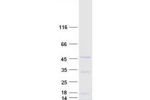 Validation with Western Blot