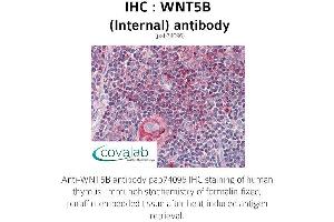 Image no. 1 for anti-Wingless-Type MMTV Integration Site Family, Member 5B (WNT5B) (Internal Region) antibody (ABIN1740832) (WNT5B anticorps  (Internal Region))