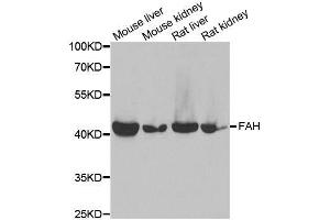 Western blot analysis of extracts of various cell lines, using FAH antibody. (FAH anticorps  (AA 1-419))