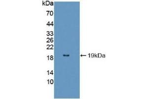 Detection of Recombinant FUM, Mouse using Polyclonal Antibody to Fumarase (FUM) (FH anticorps  (AA 42-185))