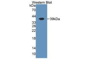 Western blot analysis of the recombinant protein. (CISH anticorps  (AA 1-258))