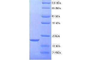 SDS-PAGE (SDS) image for Matrix Metallopeptidase 7 (Matrilysin, Uterine) (MMP7) (AA 98-267) protein (His tag) (ABIN5713654)