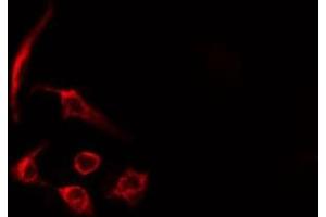 ABIN6275450 staining HeLa cells by IF/ICC.