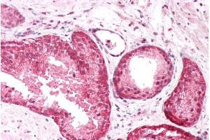 ABIN185725 (5µg/ml) staining of paraffin embedded Human Prostate. (PICK1 anticorps  (Internal Region))