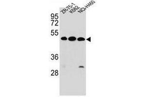 KREMEN2 Antibody (Center) western blot analysis in ZR-75-1,K562,NCI-H460 cell line lysates (35µg/lane). (KREMEN2 anticorps  (Middle Region))