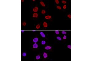 Confocal immunofluorescence analysis of U2OS cells using Ku70 Polyclonal Antibody (ABIN6134460, ABIN6150312, ABIN6150313 and ABIN6223171) at dilution of 1:100. (XRCC6 anticorps  (AA 408-609))
