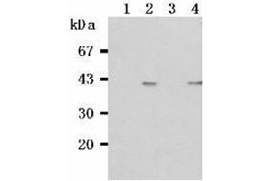 Western Blotting (WB) image for anti-Tumor Necrosis Factor Receptor Superfamily, Member 13C (TNFRSF13C) antibody (ABIN1449226) (TNFRSF13C anticorps)