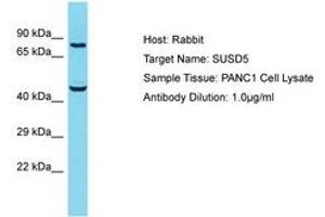 Image no. 1 for anti-Sushi Domain Containing 5 (SUSD5) (AA 304-353) antibody (ABIN6750594) (SUSD5 anticorps  (AA 304-353))