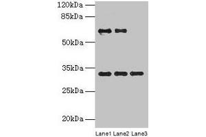 Western blot All lanes: OTX2 antibody at 4 μg/mL Lane 1: Jurkat whole cell lysate Lane 2: Hela whole cell lysate Lane 3: Mouse lung tissue Secondary Goat polyclonal to rabbit IgG at 1/10000 dilution Predicted band size: 32, 33 kDa Observed band size: 32 kDa (OTX2 anticorps  (AA 1-297))