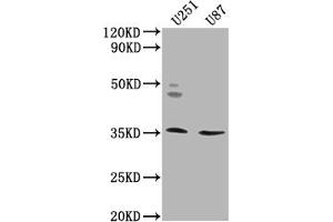 Western Blot Positive WB detected in: U251 whole cell lysate, U87 whole cell lysate All lanes: OR5K2 antibody at 1:2000 Secondary Goat polyclonal to rabbit IgG at 1/50000 dilution Predicted band size: 36 kDa Observed band size: 36 kDa (OR5K2 anticorps  (AA 6-24))