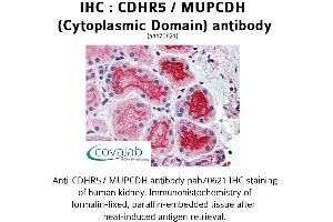 Image no. 2 for anti-Mucin and Cadherin-Like (CDHR5) (Cytoplasmic Domain) antibody (ABIN1732921) (CDHR5 anticorps  (Cytoplasmic Domain))