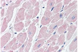Human Heart (formalin-fixed, paraffin-embedded) stained with BAI3 antibody ABIN462085 followed by biotinylated goat anti-rabbit IgG secondary antibody ABIN481713, alkaline phosphatase-streptavidin and chromogen.